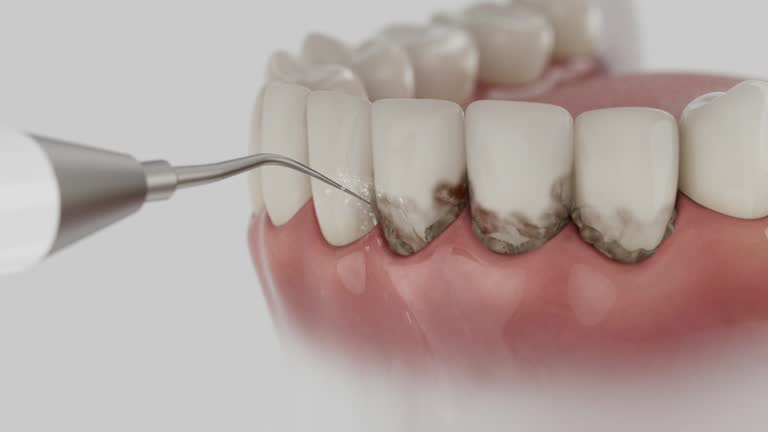 Reliable Dental contractor in Attica, IN by Dentist Open Now